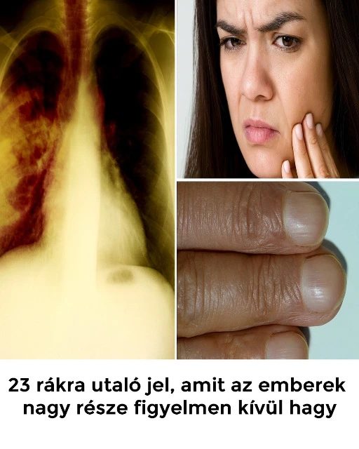23 rakra utalo jel