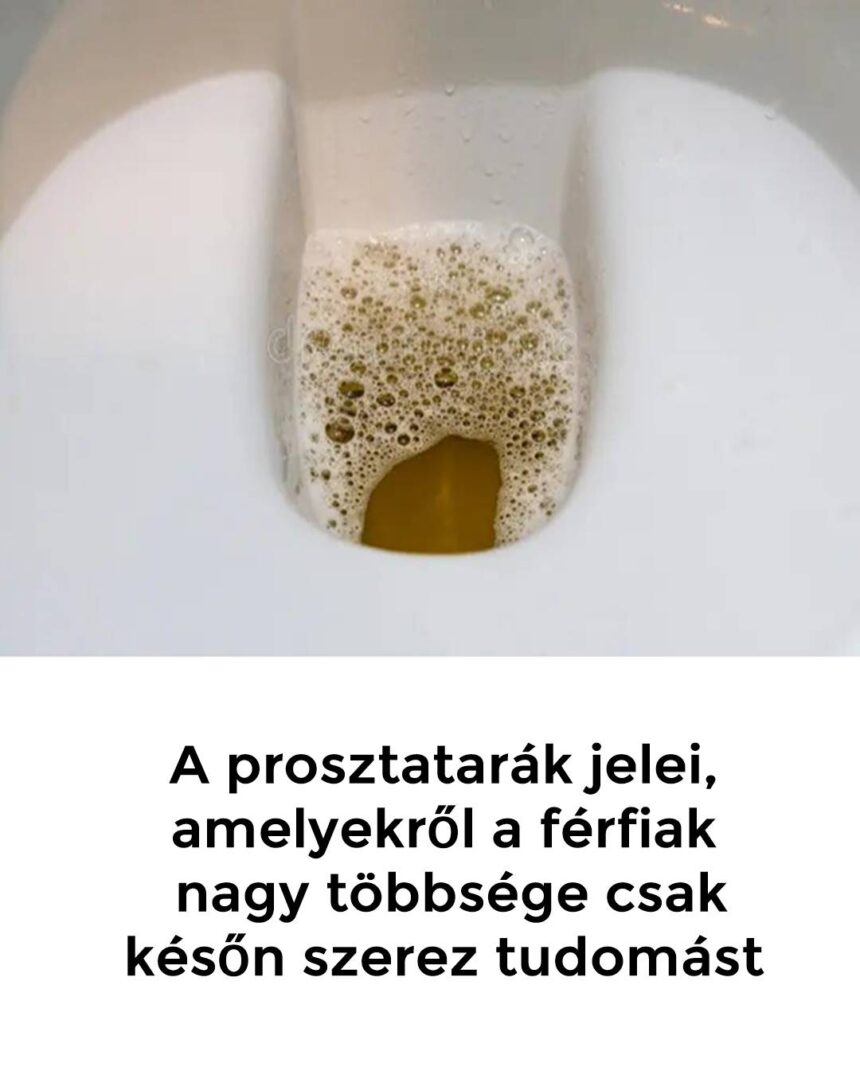 A prosztatarak jelei amelyekrol a ferfiak nagy tobbsege csak keson szerez tudomast 860x1075