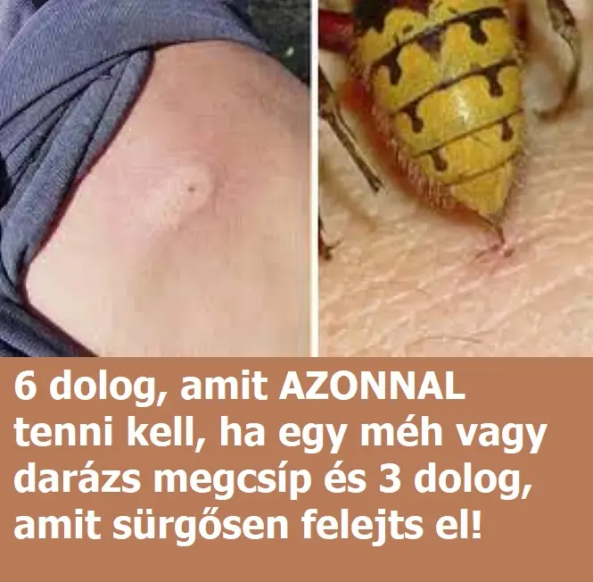 darazs21