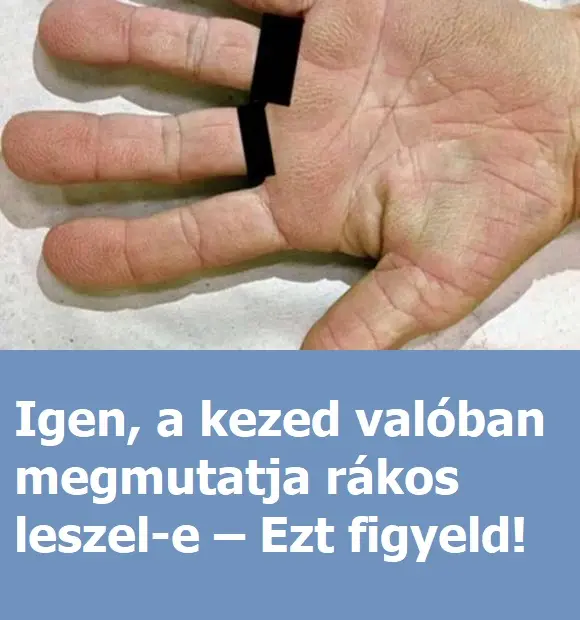 kezed dfff