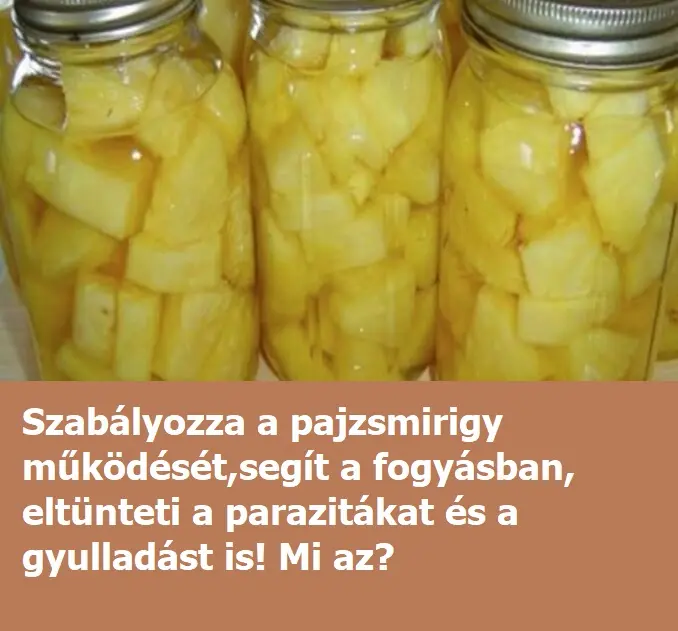 ananaszx381
