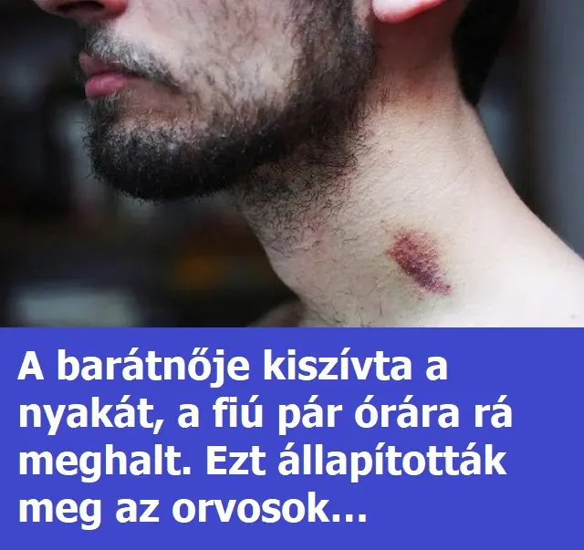 kiszivtafnyakat4