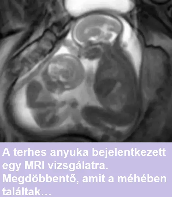 terhesnomagzatok